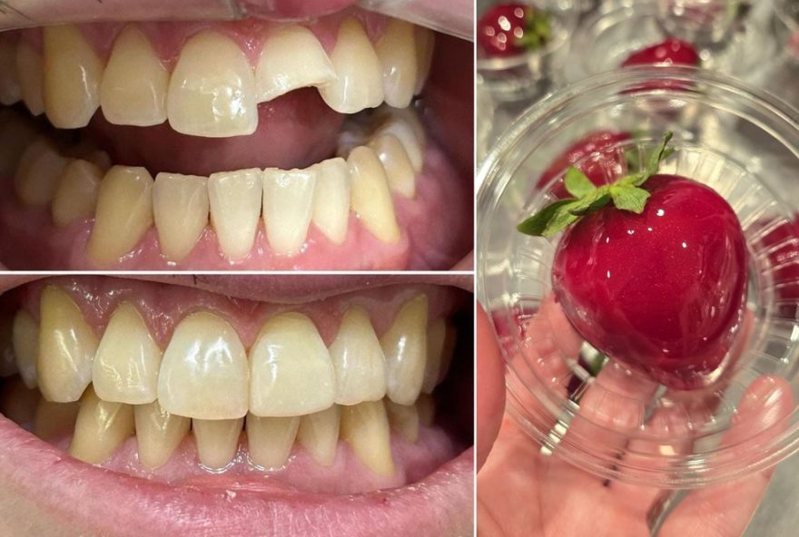 alerta-odontologico3A-morango-do-amor-causa-fraturas-dentarias2C-dentistas-recomendam-cuidado-especial