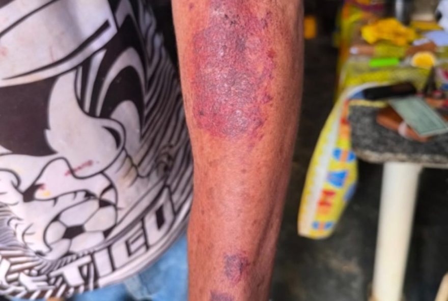 aposentado-e-brutalmente-agredido-durante-assalto-em-mg3A-suspeitos-presos-e-vitima-hospitalizada.-acao-policial-rapida-e-eficaz