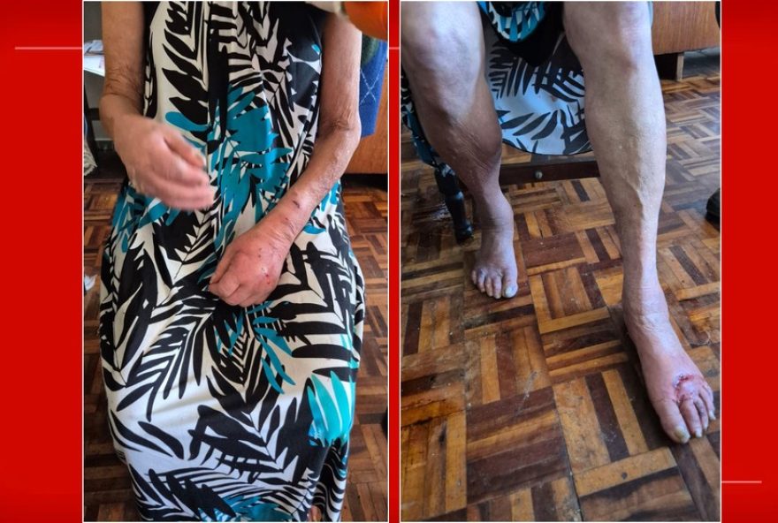 filho-preso-por-maltratar-mae-idosa-e-com-alzheimer-em-brasilia