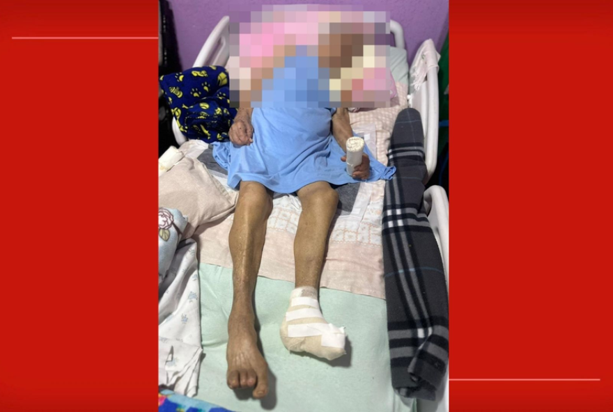 idosa-de-103-anos-tem-pe-amputado-em-casa-no-df3A-o-que-se-sabe-e-o-que-falta-saber