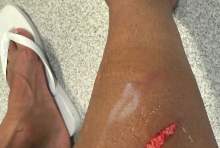 memphis-depay-exibe-corte-na-perna-em-entrada-polemica-de-gustavo-gomez3A-corinthians-x-palmeiras