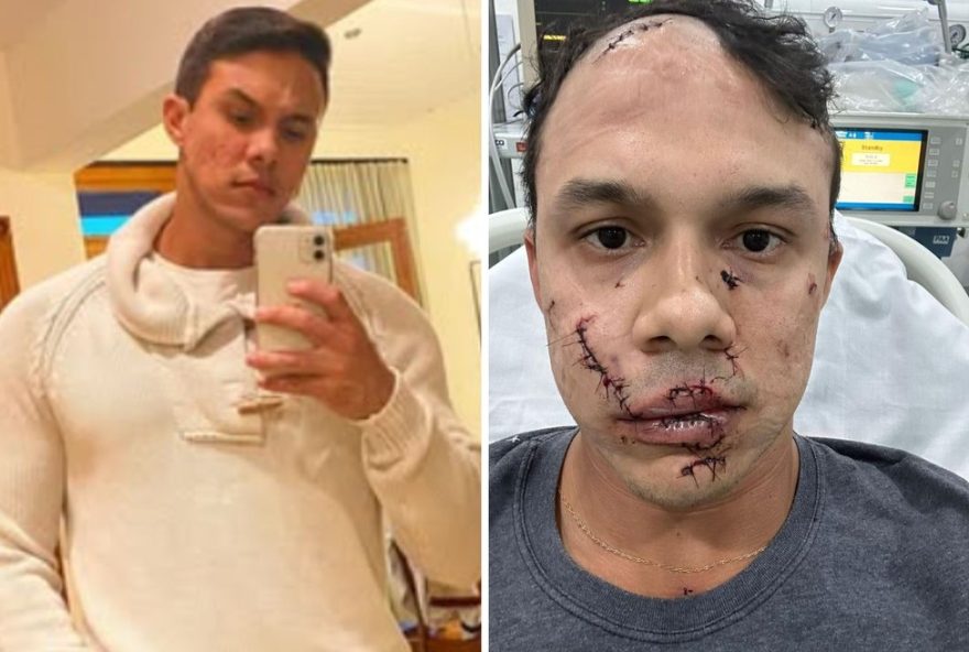 personal-trainer-recebe-45-pontos-no-rosto-apos-agressao-em-bar3A-homem-confessa-no-de-em-sp2C-confirmando-carro-em-aguas-de-lindoia